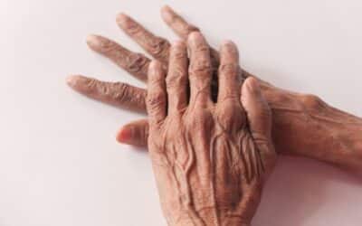 Cure Arthritis II